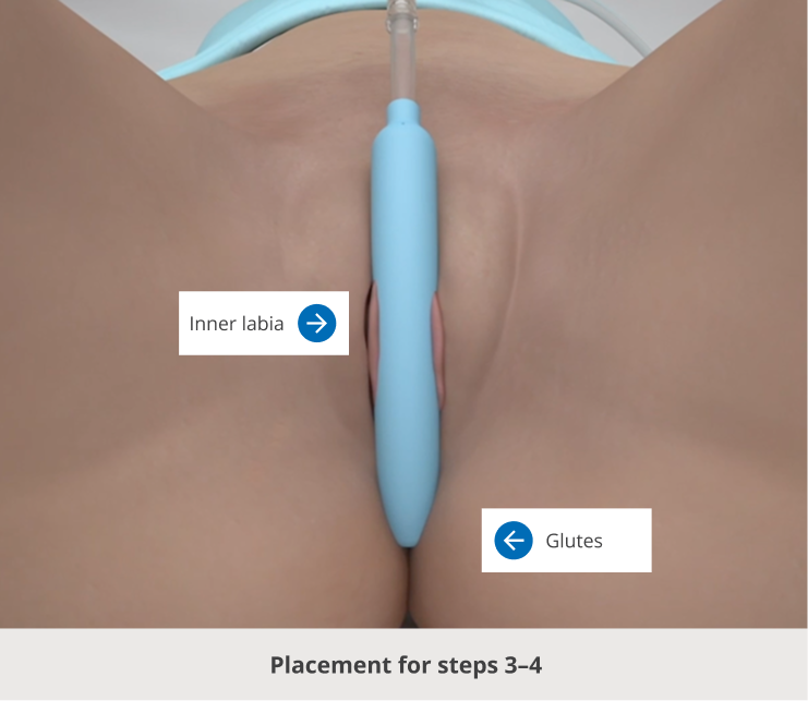 Placement for steps 3-4.